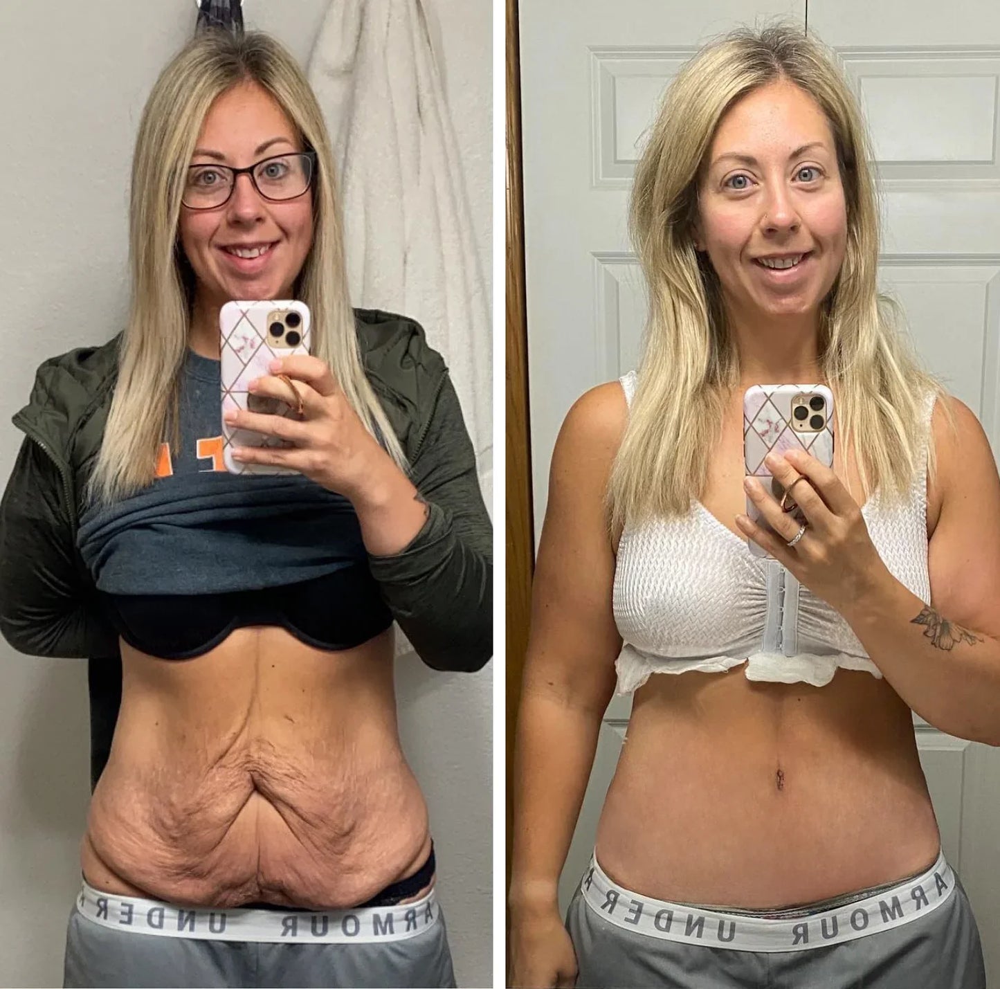 BOTOX BEE VENOM REJUVENECE Y CURA !!ENVÍO GRATIS!!